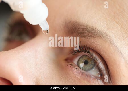 Caucasian woman using medical drops and dripping eye close up. Stock Photo
