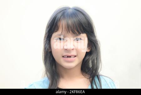 lost milk teeth - lost baby tooth , smile face of a child girl baby teeth of tooth loss , her milk tooth fell out and her growing permanent tooth in o Stock Photo