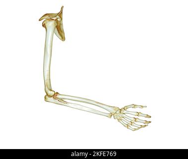 CT SCAN of Arm 3D rendering isolated on white background .Clipping path. Stock Photo