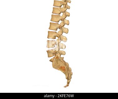 CT scan of lumbar spine 3D rendering showing Profile Human Spine. Musculoskeletal System Human Body. Structure Spine. Studying Problem Disease and Tre Stock Photo