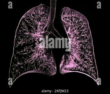 Healthy lungs, 3D CT scan Stock Photo