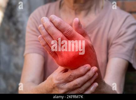 Hand joints inflammation. Concept and idea of rheumatic arthritis, rheumatism, gout, joint swelling or arthralgia. Stock Photo