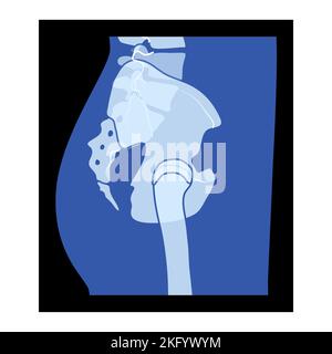 X-Ray pelvis Skeleton Hip Human body Bones adult people roentgen side view. 3D realistic flat blue color concept Vector illustration of medical anatomy isolated on black background Stock Vector