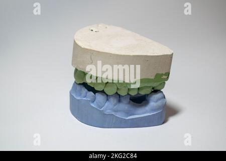 Plaster impressions of the teeth of the lower and upper jaws for prosthetics and implantation in dentistry. Stock Photo