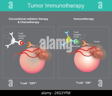 Tumor Immunotherapy. Cancer treatment that use the body's own immune system to prevent, control, and eliminate cancer cells. Stock Vector