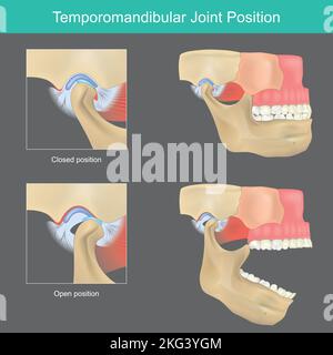 Temporomandibular joint anatomy hi-res stock photography and images - Alamy