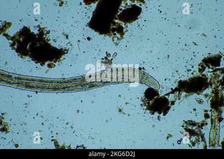 human parasite. gut intestinal infection disease. microorganism infection in hospital in people Stock Photo