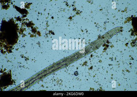 human parasite. gut intestinal infection disease. microorganism infection in hospital in people Stock Photo