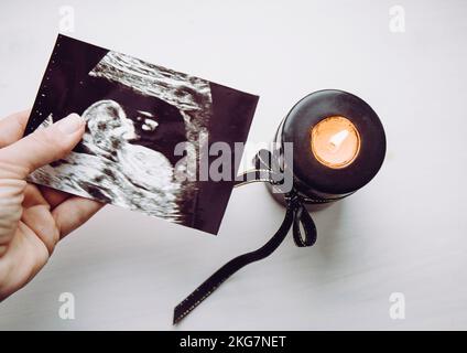 Conceptual image of woman mourning, miscarriage. Mother hand holding ultrasound picture of baby. Black candle with black ribbon burning. Stock Photo