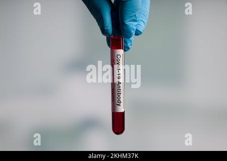 hand in medical gloves is handling a blood probe for covid analysis in a laboratory Stock Photo