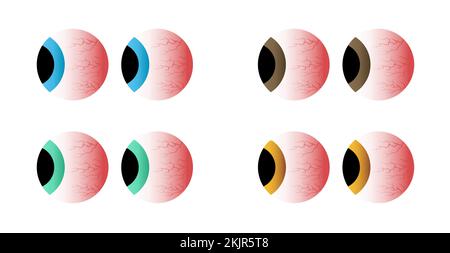 Red eyes different colors set. Sick stress, sleep insomnia disorder, capillaries and pupils. Stock Vector