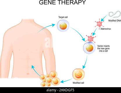 Genetic engineering. Gene therapy using an adenovirus vector. virus inserts the new gene into a cell, that will make proteins to treat a disease Stock Vector