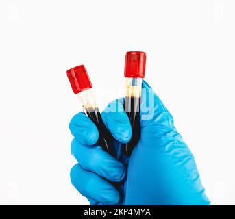A blood test sample tube with a red cap is in the hand of a blue gloved doctor, object isolated on white background, hematology healthcare laboratory Stock Photo