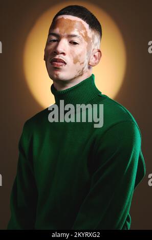 Vitiligo, portrait and male fashion model in stylish, trendy and fashionable outfit on a brown studio background. Backdrop, edgy and artistic man Stock Photo