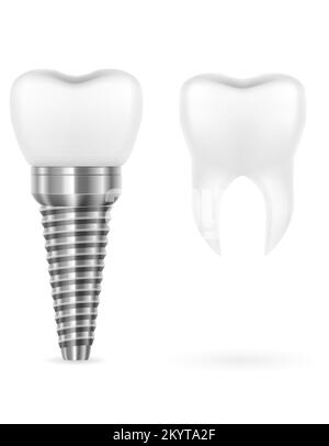 metal human tooth implant vector illustration isolated on white background Stock Vector