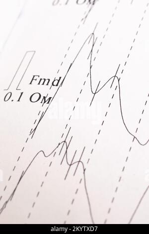 Research schedule Rheoencephalography on a white paper close up Stock Photo