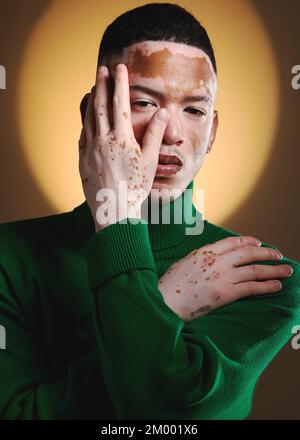 Vitiligo, man face and fashion model portrait for luxury beauty, style and designer brand. Skin pigmentation, hand pose and model posing for expensive Stock Photo