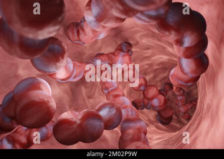 Strep A bacterial structure in a throat. Illustration of the infection of invasive group A streptococcal (iGAS) disease Stock Photo