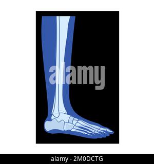 X-Ray Foot Legs Skeleton, Fibula, Tibia - Phalanges Human Body, Bones ...