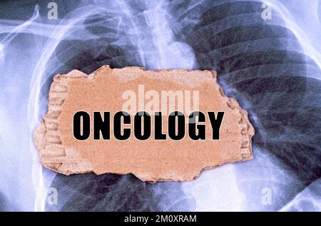 Medicine concept. On the X-ray there is a piece of cardboard with the inscription - oncology Stock Photo