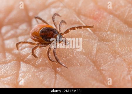 Close-up of deer tick on human skin detail in background. Ixodes ricinus or scapularis. Infectious diseases carrier. Encephalitis or Lyme borreliosis. Stock Photo