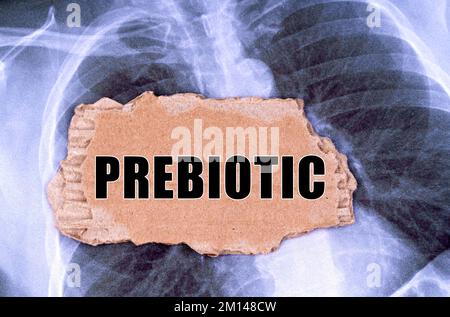 Medicine concept. On the X-ray there is a piece of cardboard with the inscription - PREBIOTIC Stock Photo