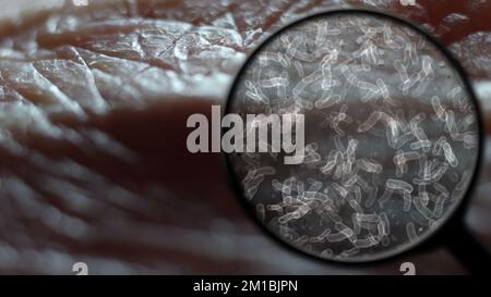 Searching for bacteria on human skin Stock Photo