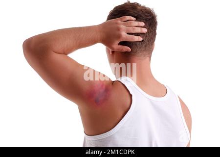 Man with bruise on shoulder against white background Stock Photo