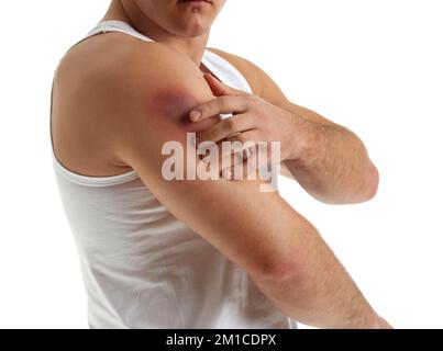 Man with bruise on shoulder against white background Stock Photo