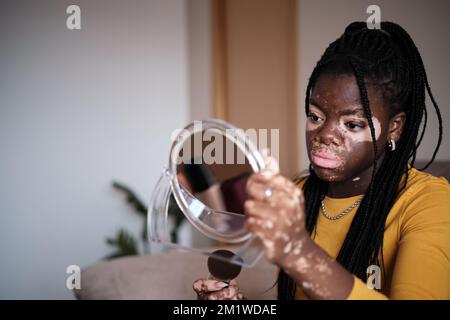 African American lady applying powder on face with vitiligo Stock Photo