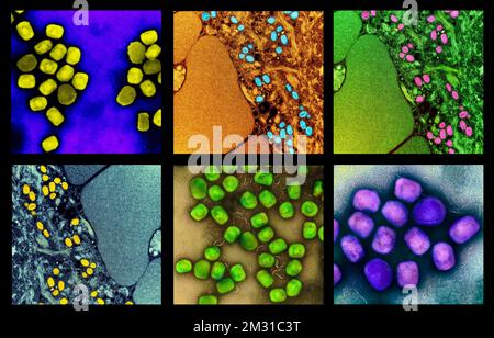 A composite of images of the monkeypox virus.  An optimised and enhanced unique composite version of six scanning electron micrograph images, Credit: NIAID Stock Photo