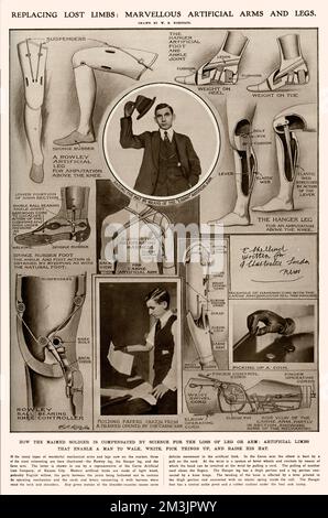Diagram and photograph montage showing three different types of artificial limbs available to wounded soldiers;  the Rowley leg, the Hanger leg and the Carne arm.  It was estimated that a total of one million men lost limbs during World War I.  1915 Stock Photo