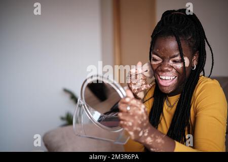 Happy black lady applying powder on vitiligo skin at home Stock Photo