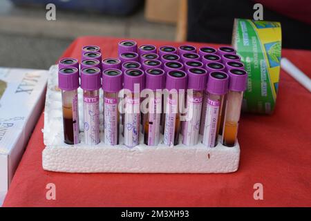 Cairo, Egypt, December 15 2022: blood samples in tubes collected from donors for ABO typing and laboratory investigations analysis against viruses dur Stock Photo