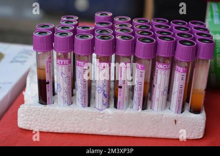 Cairo, Egypt, December 15 2022: blood samples in tubes collected from donors for ABO typing and laboratory investigations analysis against viruses dur Stock Photo