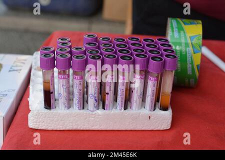 Cairo, Egypt, December 15 2022: blood samples in tubes collected from donors for ABO typing and laboratory investigations analysis against viruses dur Stock Photo