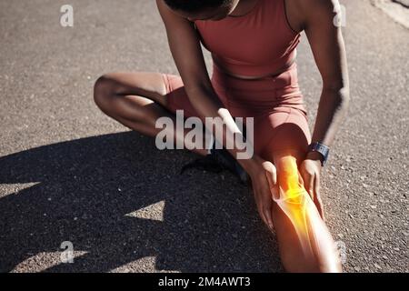 X ray, leg injury and black woman training with medical pain, body strain and emergency during a sports marathon. Painful, broken muscle and African Stock Photo
