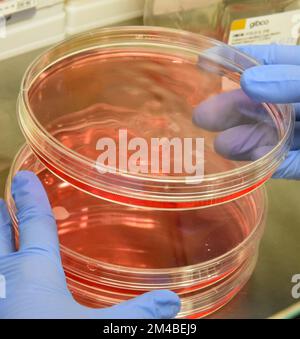 19 December 2022, Saxony, Leipzig: Petri dishes containing cell cultures from a young patient with extreme obesity are seen in an incubator. According to a press release from the University of Leipzig, a research team at the medical school was able to discover a new mechanism associated with an unusual expression of a gene, with the control of hunger pangs and with severe obesity in children. The goal of the research, he said, is to translate findings from genetic studies into future personalized treatments for obesity. Obesity and resulting diseases are among the leading causes of death world Stock Photo