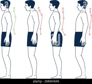 Male body with right and wrong spine postures. Body positions Stock Vector