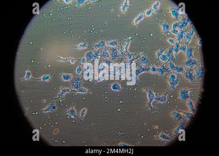 Top down view microscopic view small formations through microscope. Human cancer cells on an agar plate. Stock Photo