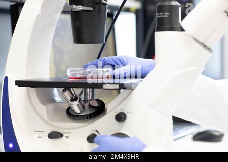 Scientist with petri dish examining medical sample through microscope Stock Photo