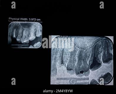 Dental x-ray image, teeth x-ray film. Stock Photo