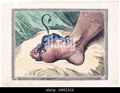 Artist James Gillray powerfully illustrates the pain and suffering caused by gout, a common ailment of his time. Published 1799 Stock Photo