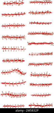 Suture icons set cartoon vector. Wound surgical. Doctor laceration Stock Vector