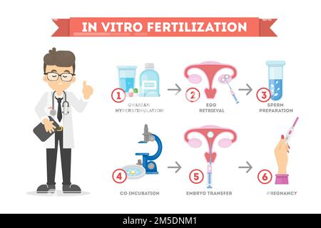 In vitro fertilization process in infographic. Young couple and doctor ...