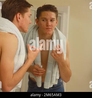 Teenage boy with bad acne problem standing in front of a mirror getting ready to apply medicine to his face Stock Photo