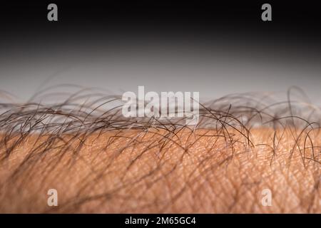 Human skin with hair on dark background. Goose bumps. Stock Photo