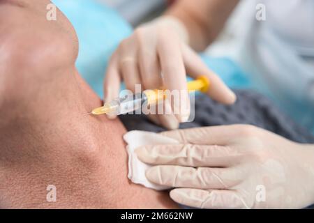 Doctor injecting platelet rich plasma into skin of human neck Stock Photo