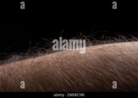 Human skin with hair on black background. Goose bumps. Stock Photo