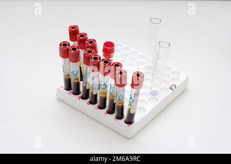 Biochemical laboratory. Test tubes with blood in the holder Stock Photo